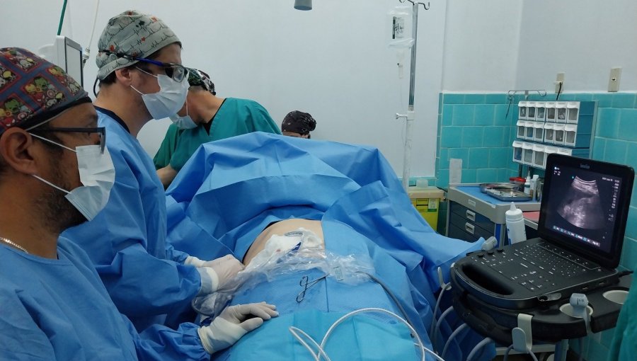 Realizan innovador procedimiento para “quemar” tumor hepático con energía de microondas en Hospital Pereira de Valparaíso