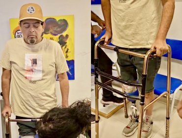 El «Indio» de Dinamita Show muestra cómo se recupera tras sufrir amputación de su pierna