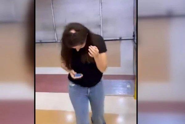 Sernac se hace parte en querella contra peluquería tras quemaduras en una joven en Quilpué