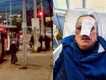 Dos sujetos fueron detenidos por salvaje golpiza a conductor de micro en Villa Alemana