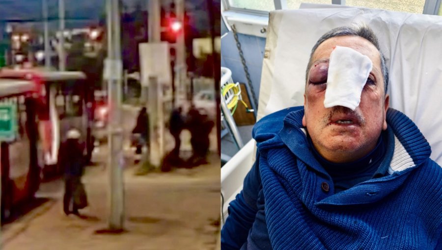 Dos sujetos fueron detenidos por salvaje golpiza a conductor de micro en Villa Alemana