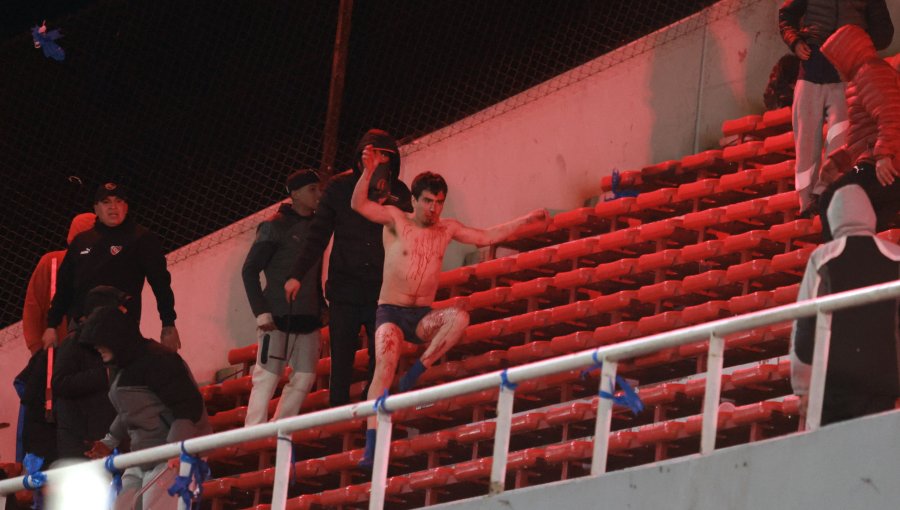 19 hinchas de la "U" lesionados tras violentos incidentes en Argentina: uno en riesgo vital