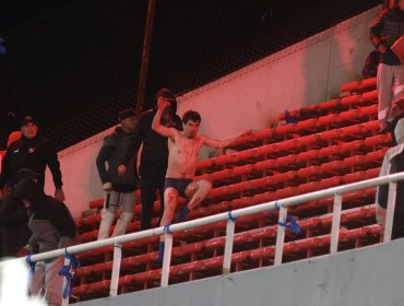 19 hinchas de la "U" lesionados tras violentos incidentes en Argentina: uno en riesgo vital