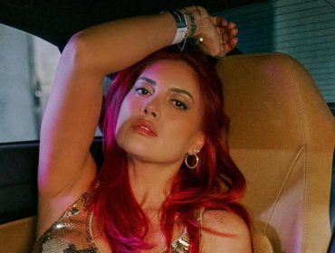 Karen Paola aclaró el motivo de su ingreso a pabellón y descarta nueva cirugía estética: "Tengo que cuidarme"