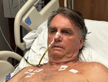Bolsonaro sigue hospitalizado por problema renal y anemia