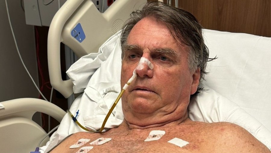 Bolsonaro sigue hospitalizado por problema renal y anemia