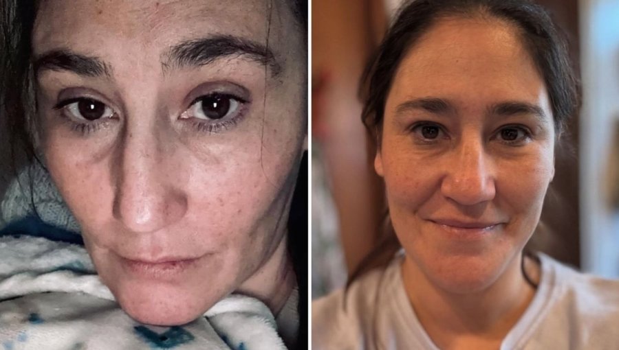 Belén Mora vive angustiante crisis de salud y preocupa a sus seguidores: "Pensé que me iba a morir"