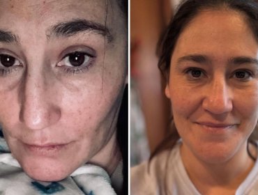 Belén Mora vive angustiante crisis de salud y preocupa a sus seguidores: "Pensé que me iba a morir"