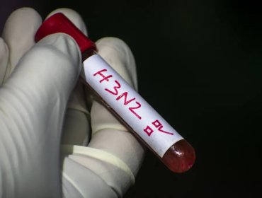 Ministerio de Salud advierte que "súper gripe" H3N2 ya habría llegado a Chile por alta movilidad