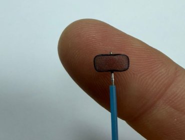 Hospital Van Buren de Valparaíso implementa innovador tratamiento para aneurismas cerebrales rotos