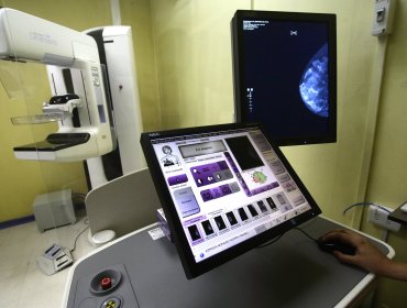 Solo 20% de cobertura en mamografías: Urgente llamado a fortalecer estrategia nacional de tamizaje de cáncer de mama