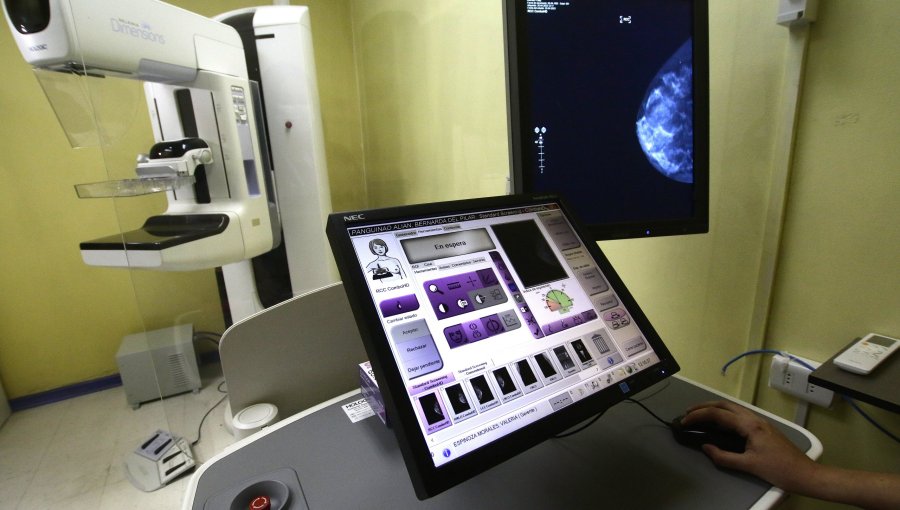 Solo 20% de cobertura en mamografías: Urgente llamado a fortalecer estrategia nacional de tamizaje de cáncer de mama