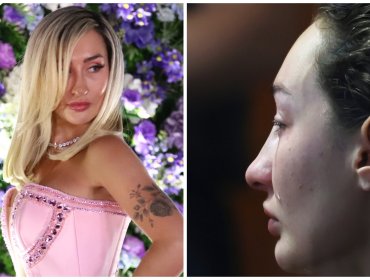 Fran Maira admite que accidente en Lo Barnechea "fue el peor momento de mi vida”
