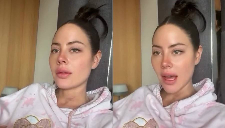 "Estaba a punto de desmayarme": Ignacia Michelson rompe el silencio tras su abrupta salida de Miss Universo Chile