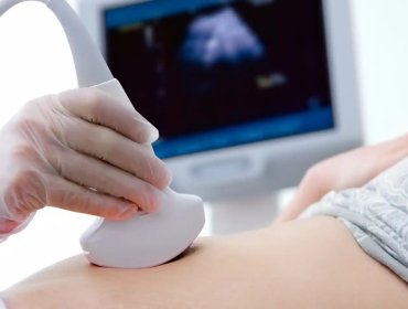 Proyecto “Escucha su corazón”: Cadem revela que un 66% se opone a obligar a mostrar latidos antes de un aborto