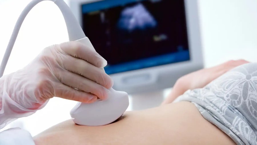 Proyecto “Escucha su corazón”: Cadem revela que un 66% se opone a obligar a mostrar latidos antes de un aborto