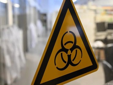 OMS monitorea muerte de investigadora en laboratorio de Rusia por sospecha de peste neumónica